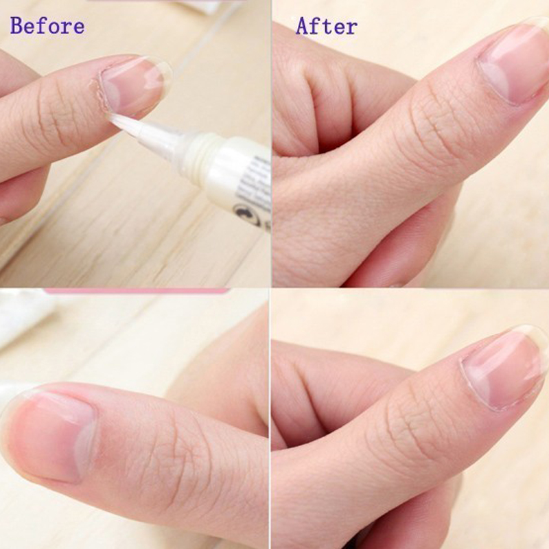 1pcs Cuticle Olie Pen Nagel Vo - Cuticle Oil Pen recensie en prijs